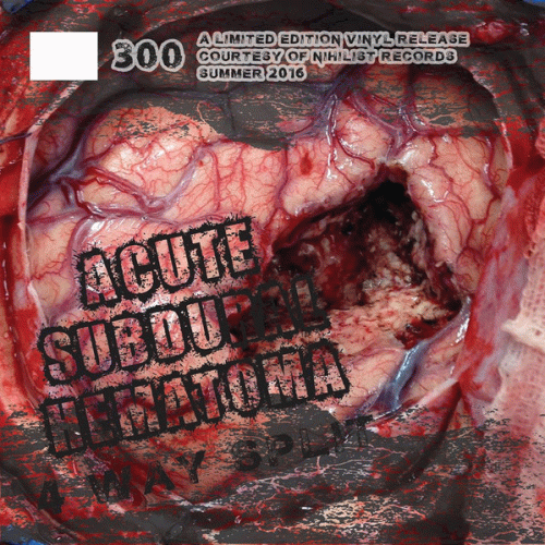 Ulcer (USA) : Acute Subdural Hematoma 4 Way Split